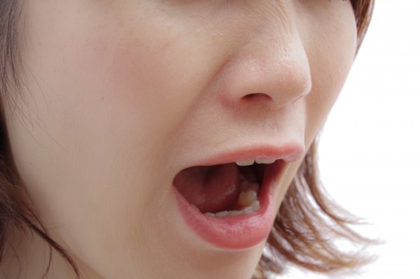 画像はイメージ